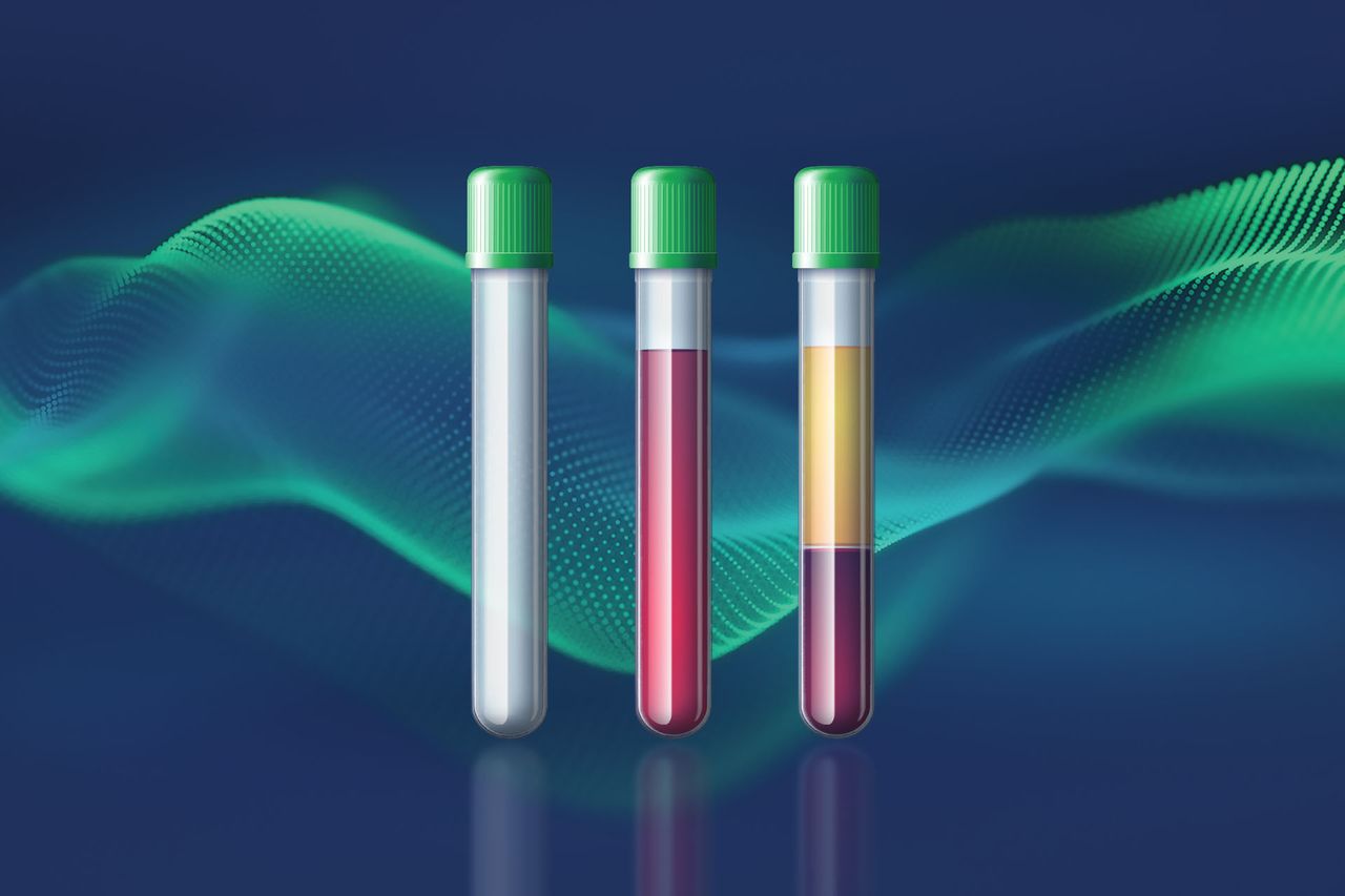 Sample processing