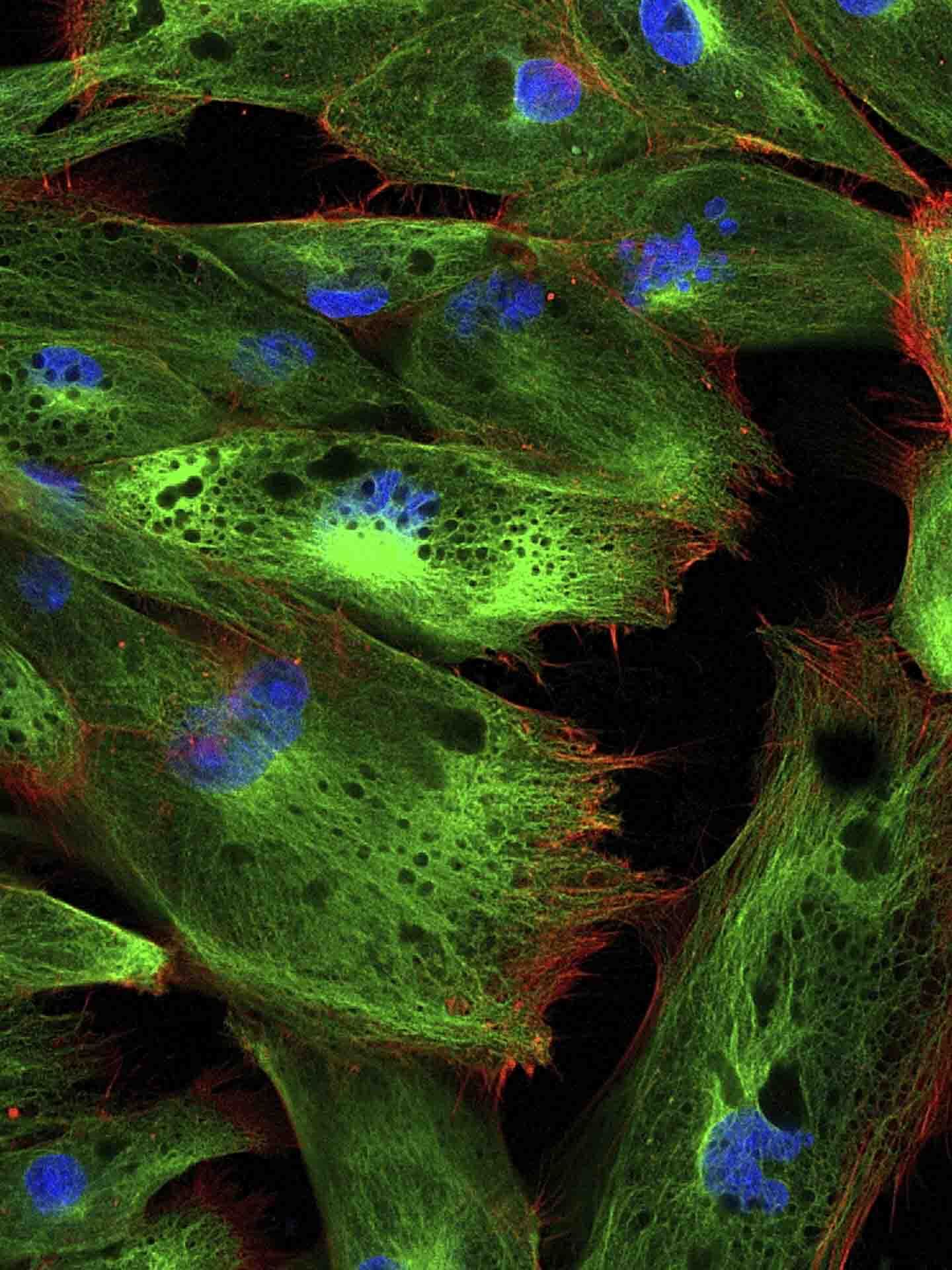 Cell imaging