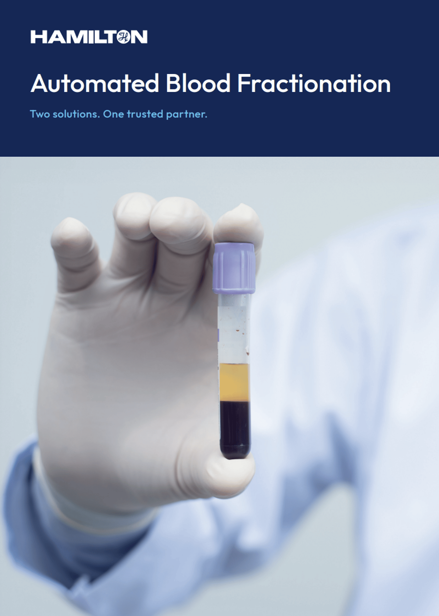 Gloved hand holding a blood collection tube showing separated plasma and blood layers, purple cap