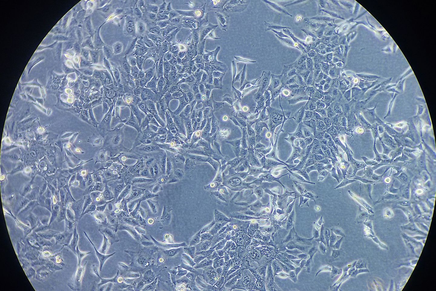 cancer cells