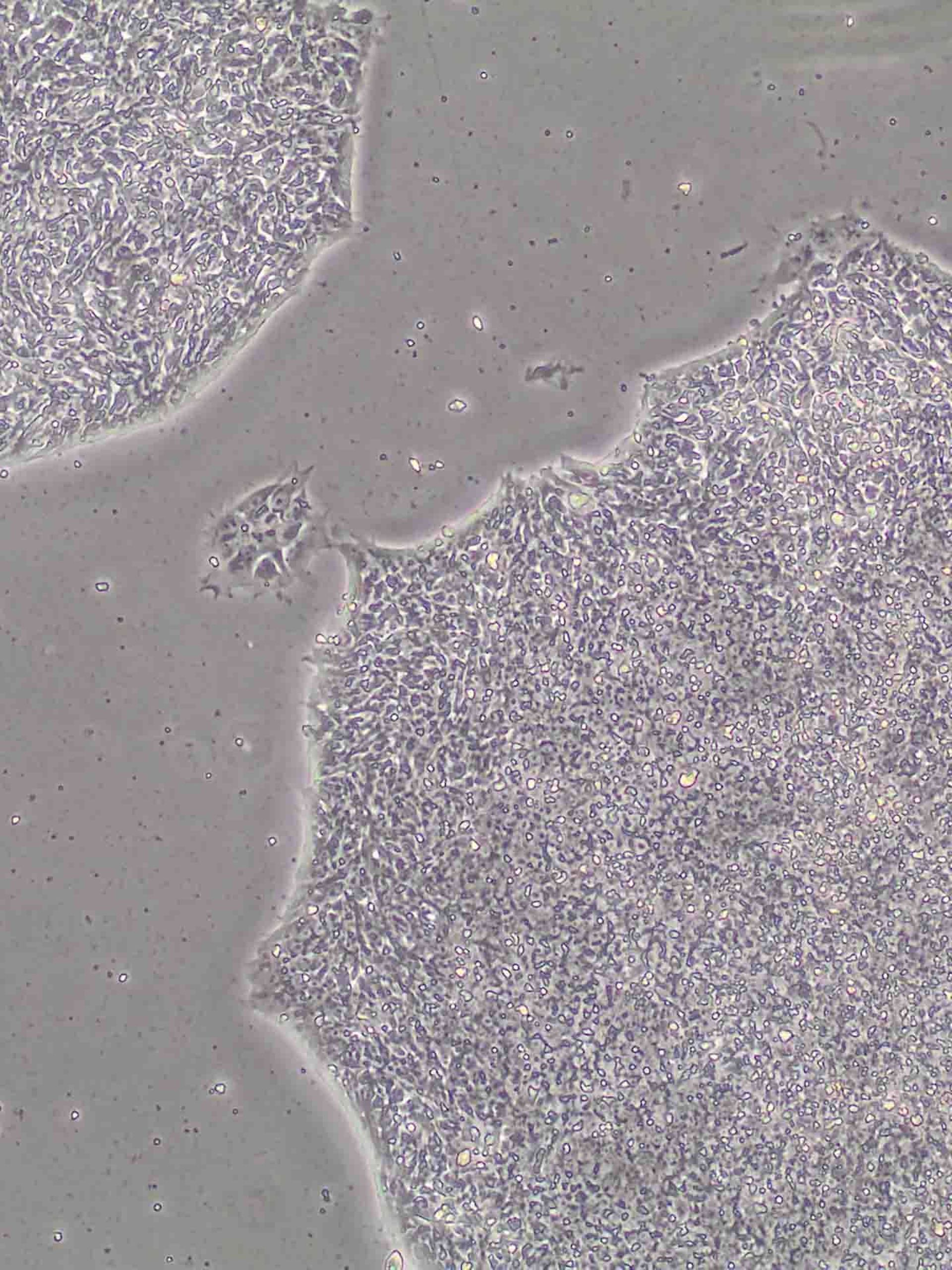 Ips cells
