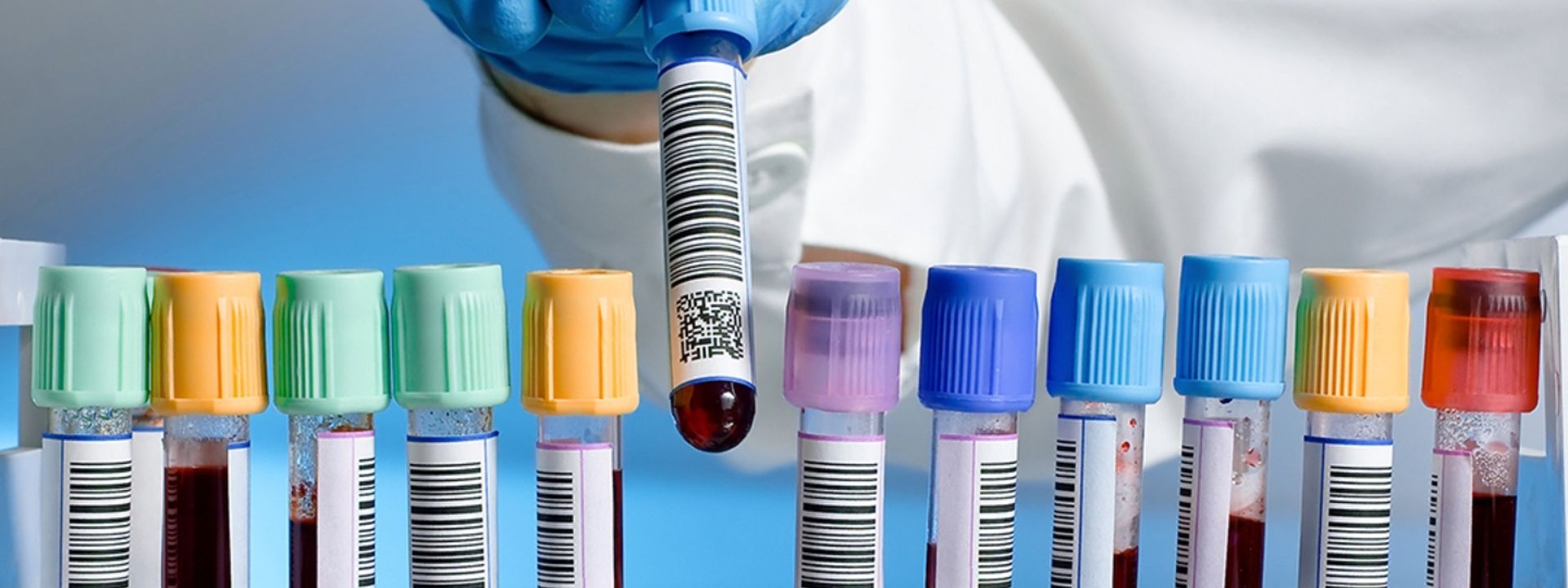 Gloved hand placing a barcoded blood collection tube into a rack of labeled sample tubes with colored caps